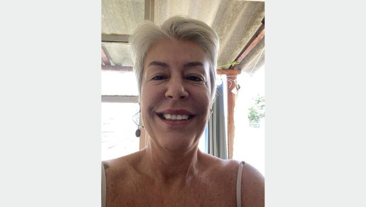 "Depoimento da cliente Mônica Guarine sobre tratamento estético na Irene Fênix"